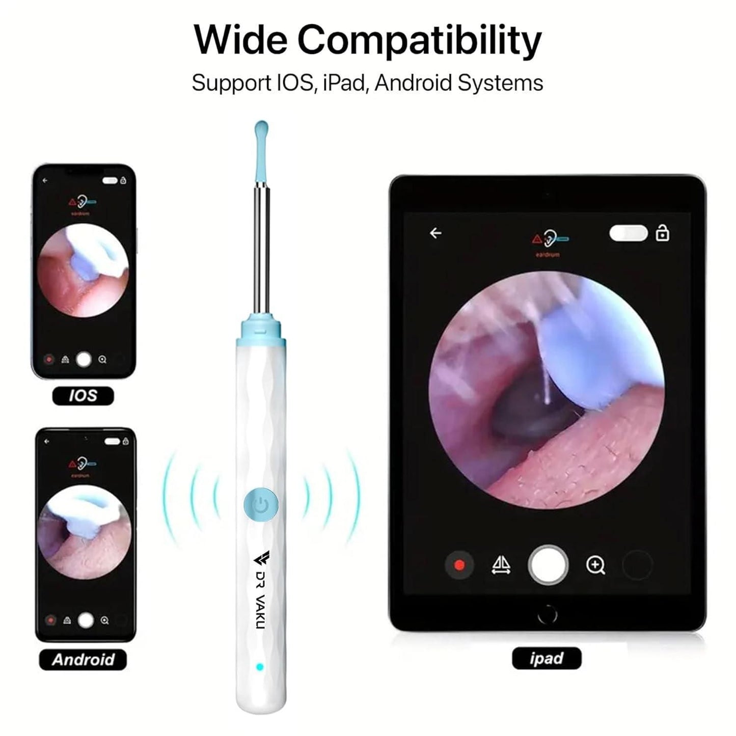 Premium Smart Video Ear Wax Cleaner™ – 100% Safe & Painless Ear Care with HD Camera