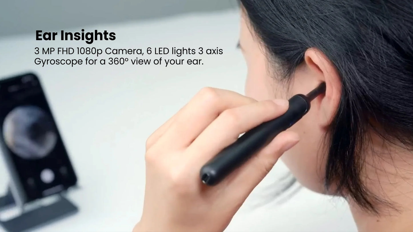 Premium Smart Video Ear Wax Cleaner™ – 100% Safe & Painless Ear Care with HD Camera