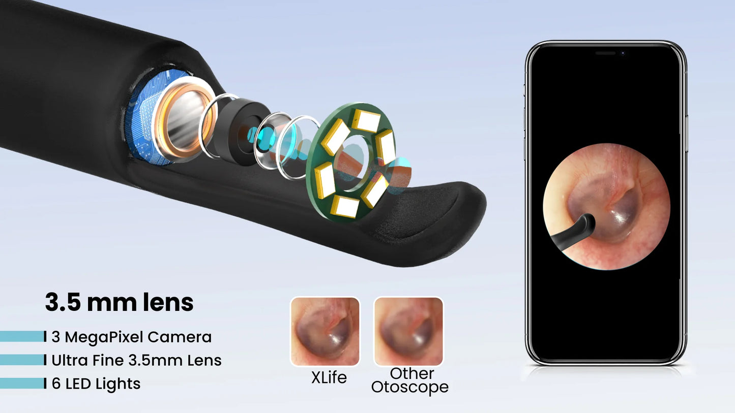 Premium Smart Video Ear Wax Cleaner™ – 100% Safe & Painless Ear Care with HD Camera